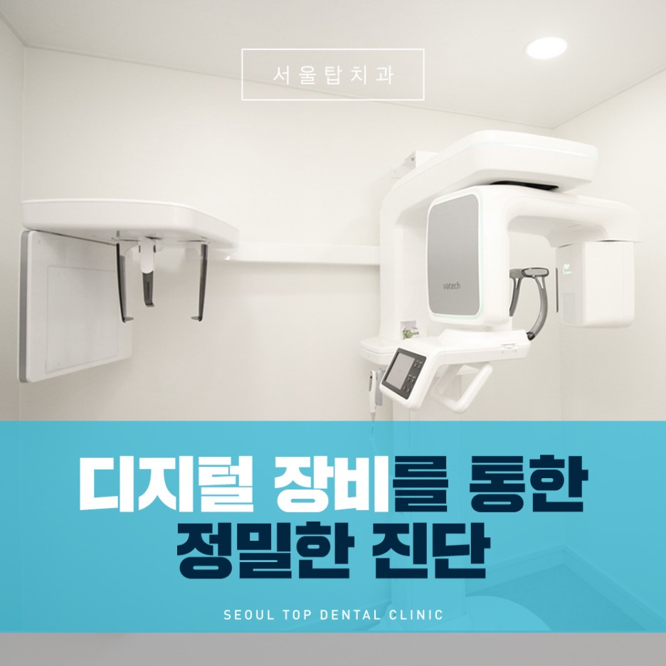 서울탑치과 임플란트