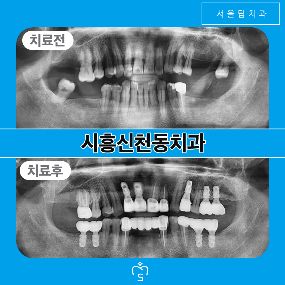 시흥신천동치과
