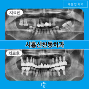 시흥신천동치과