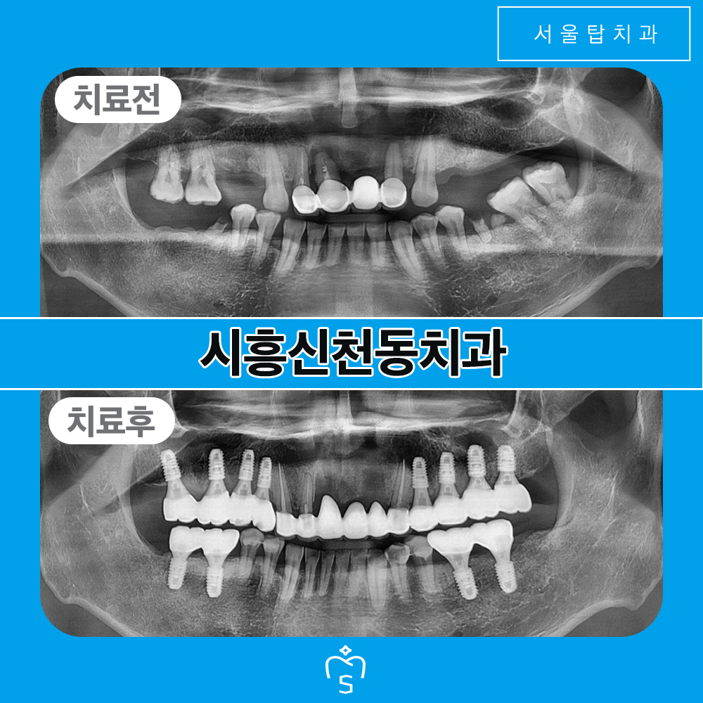 시흥신천동치과